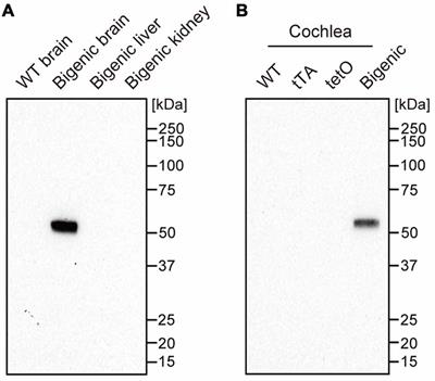 Hearing Loss Controlled by Optogenetic Stimulation of Nonexcitable Nonglial Cells in the Cochlea of the Inner Ear